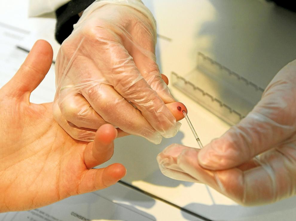 El test rápido de VIH se desarrolla en 20 minutos con una gota de sangre.