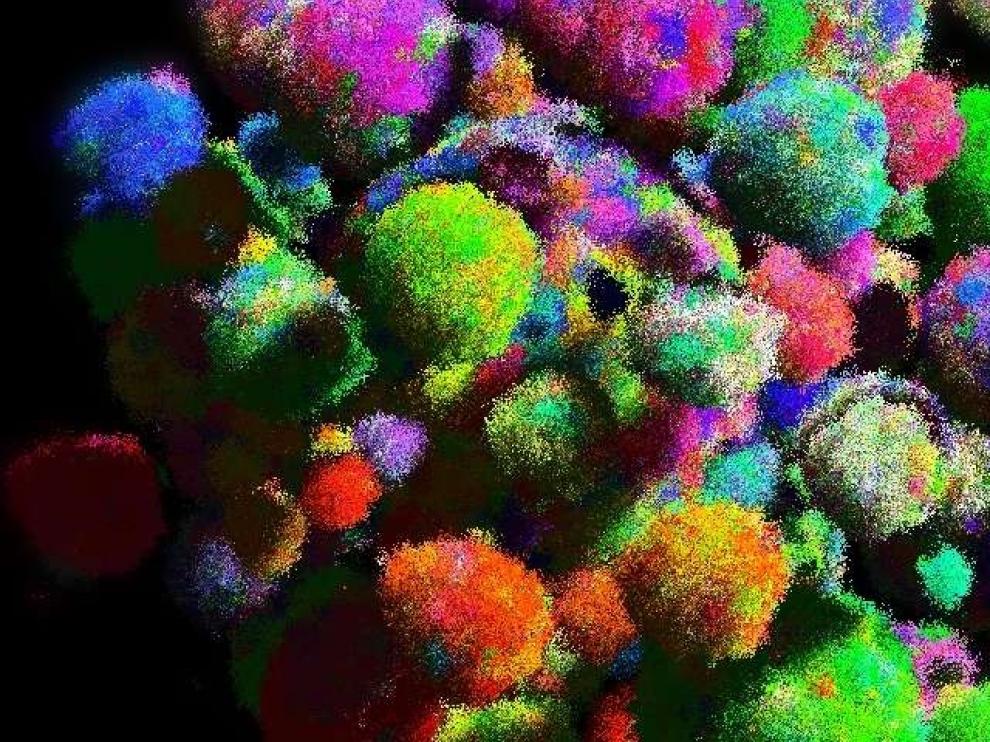 Un modelo tridimensional de un tumor que muestra los tipos de células en diferentes colores.