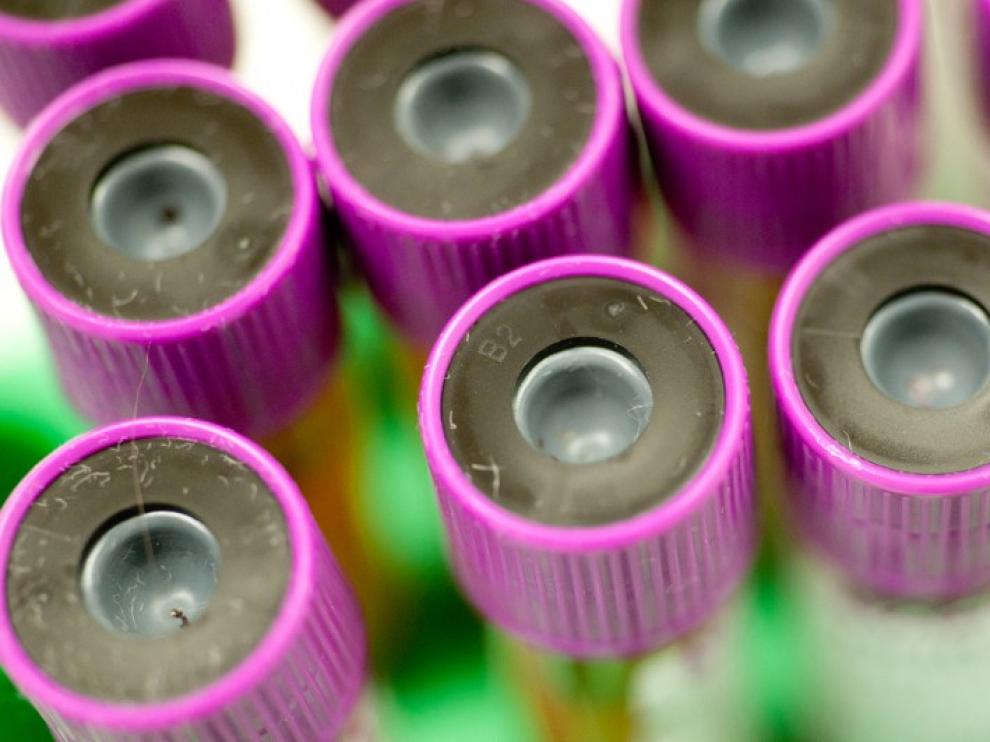 Cada síntoma adicional de cáncer reconocido se asoció con un aumento del 1,6% en la supervivencia global.