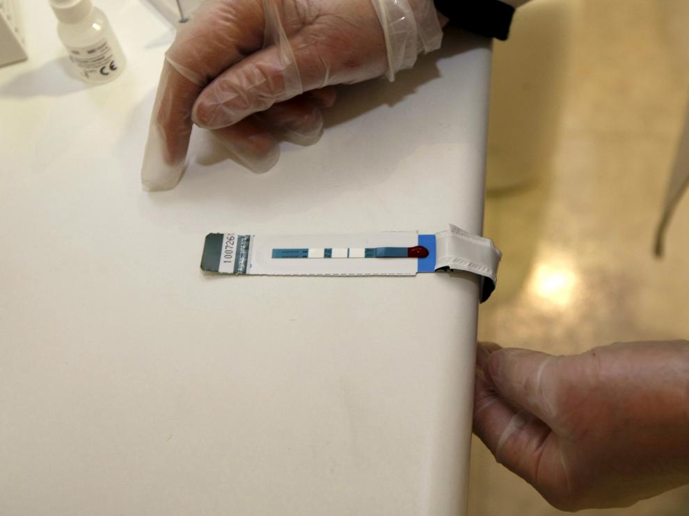 Test rápido del VIH en las farmacias de Aragón.