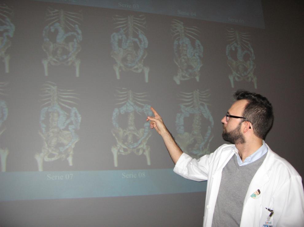 El doctor Fernando Trebolle ante imágenes recogidas en la tesis