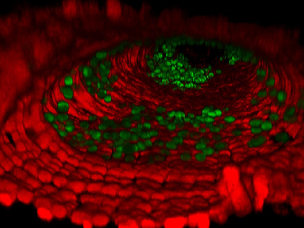 Una imagen del crecimiento de las células tumorales en el intestino de una mosca de la fruta.