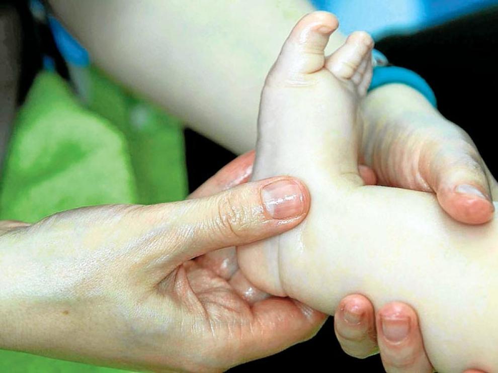 Los menores de tres años son los más propensos a sufrir esta enfermedad
