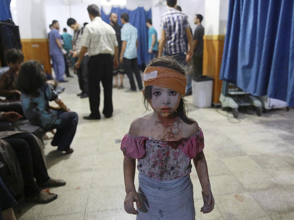 Imagen de una niña siria atendida en un hospital de Damasco (de la serie ganadora del World Press Photo).