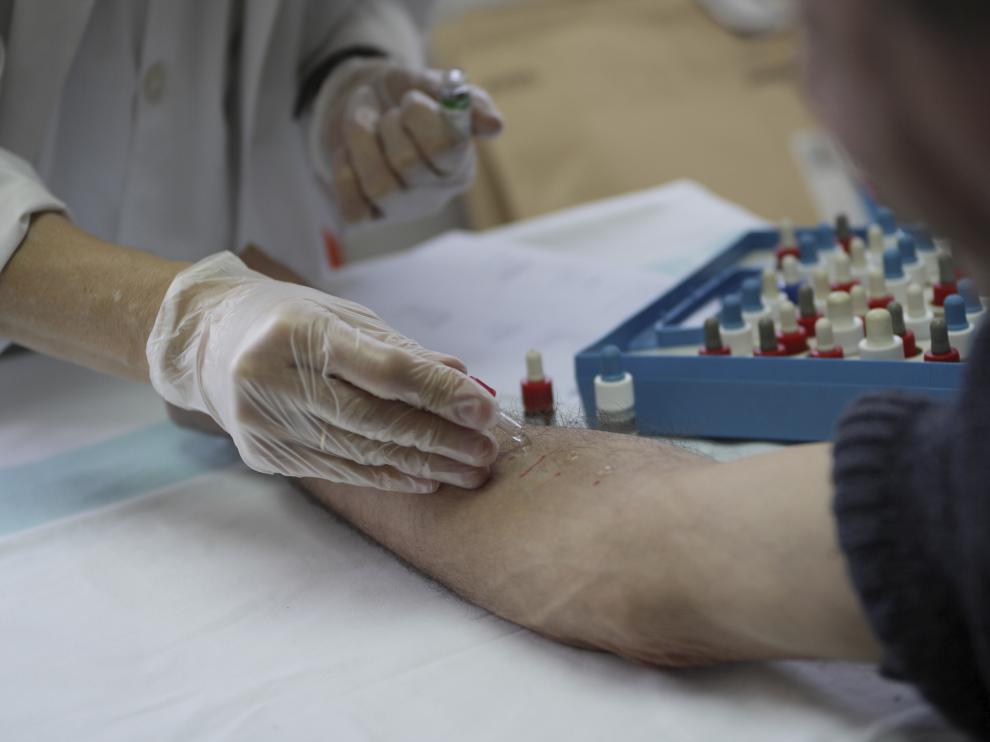Los exámenes para detectar las alergias acumulan retrasos de más de seis meses.