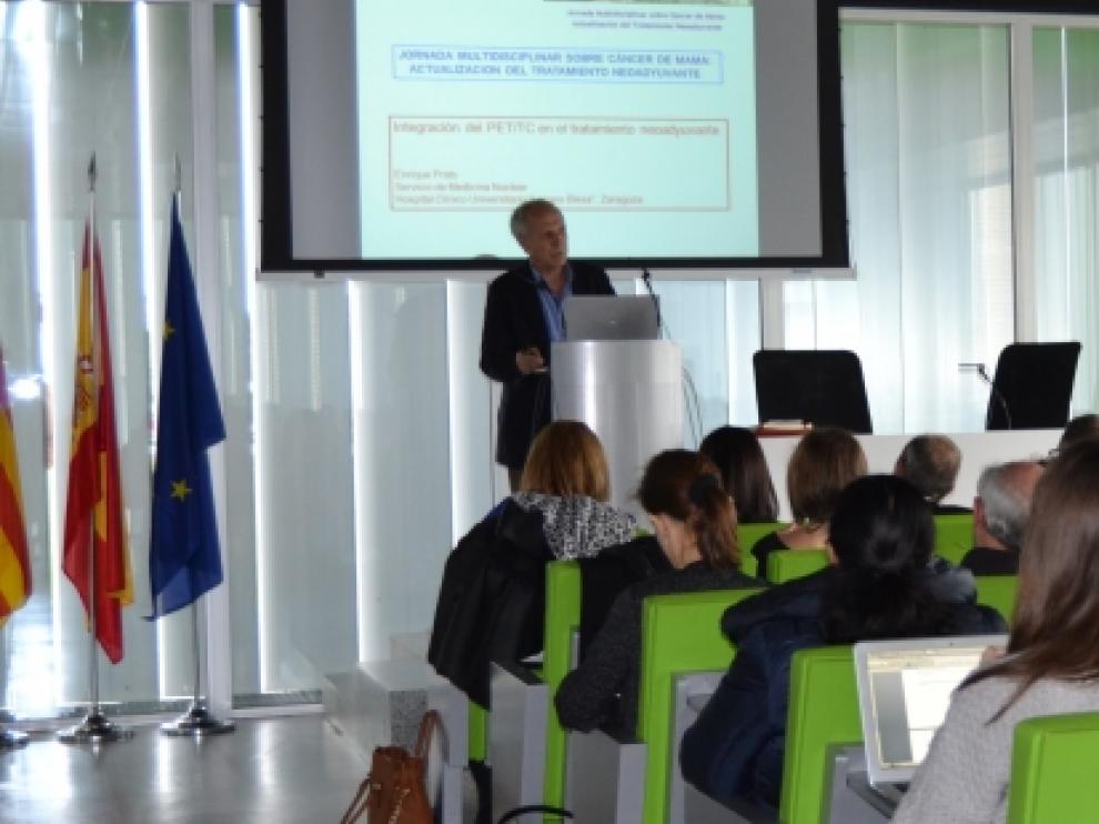 Una jornada aborda en el CIBA el papel de las unidades multidisciplinares de cáncer de mama.