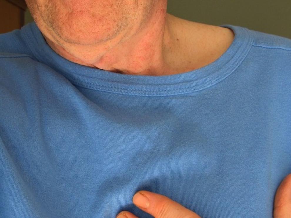 El riesgo de morir por un infarto de corazón o cerebral aumenta con la edad.
