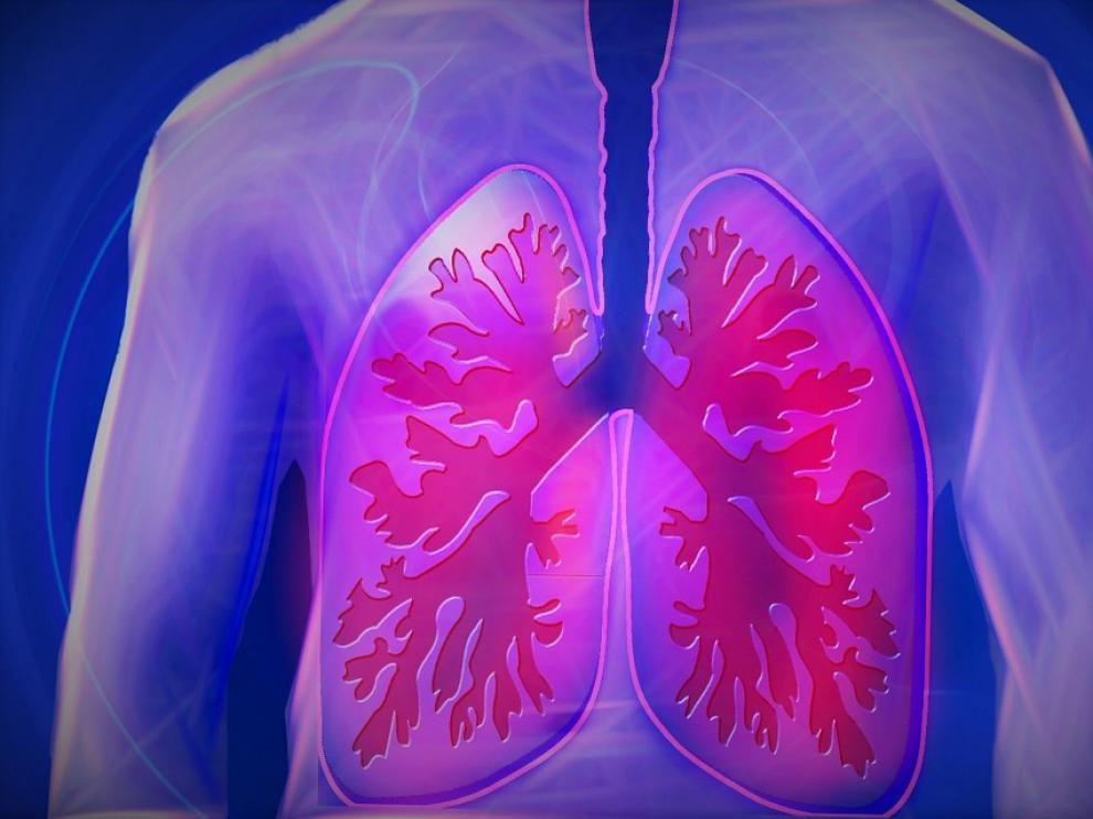 La EPOC afecta a la salud pulmonar.