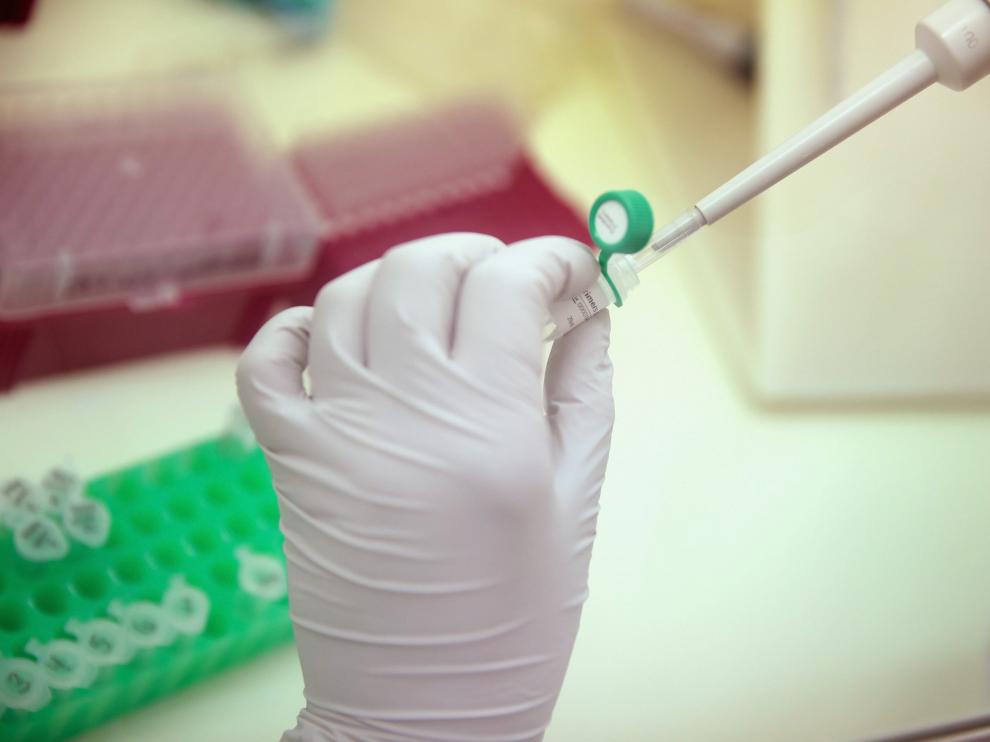 Científicos de la Universidad de Wisconsin investigan la transmisión del virus del zika.