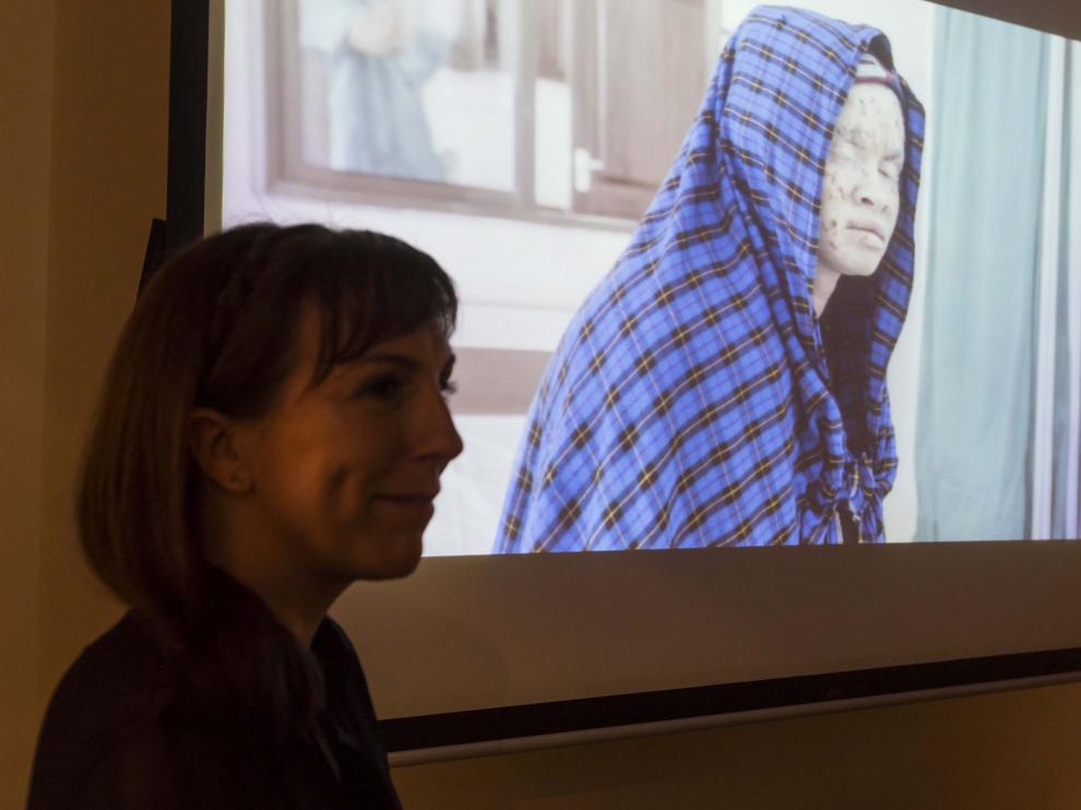 La autora del libro con la imagen de fondo de uno de los jóvenes albinos que aparecen en la publicación.