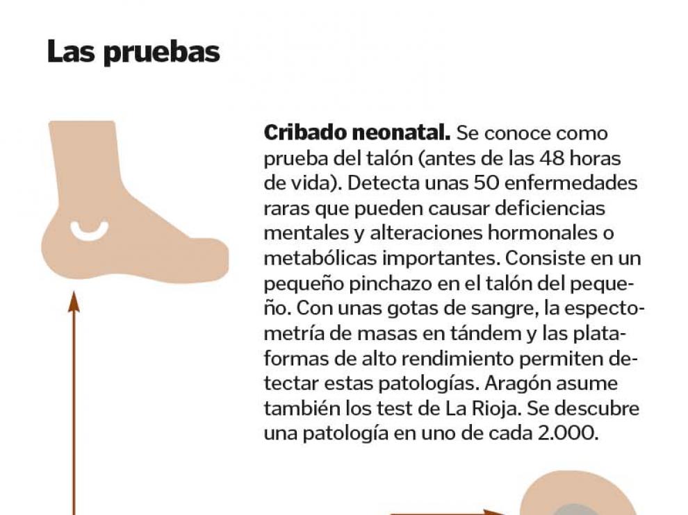 Así son las pruebas.