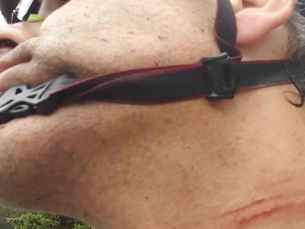 Imagen publicada por el ciclista, donde pueden apreciarse las heridas provocadas por la 'trampa'.