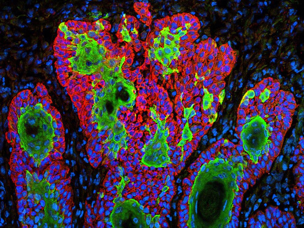 El proyecto Reproducibilidad se centra ahora en los estudios sobre cáncer