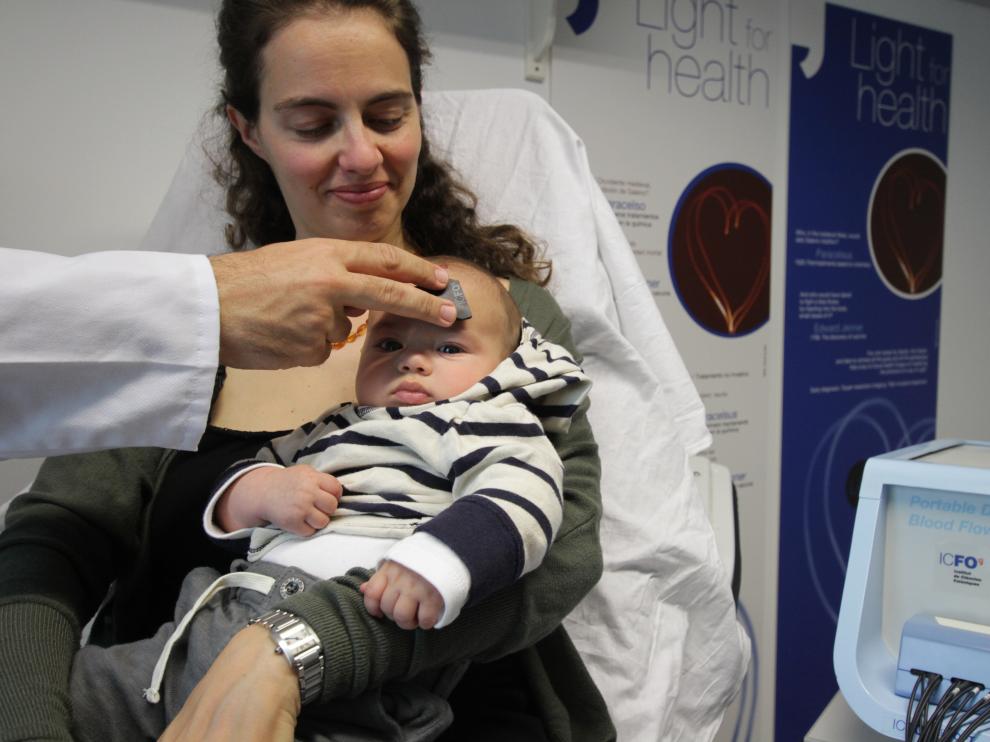 Monitoreo del flujo sanguíneo cerebral de un bebé con un dispositivo de monitorización hemodinámica