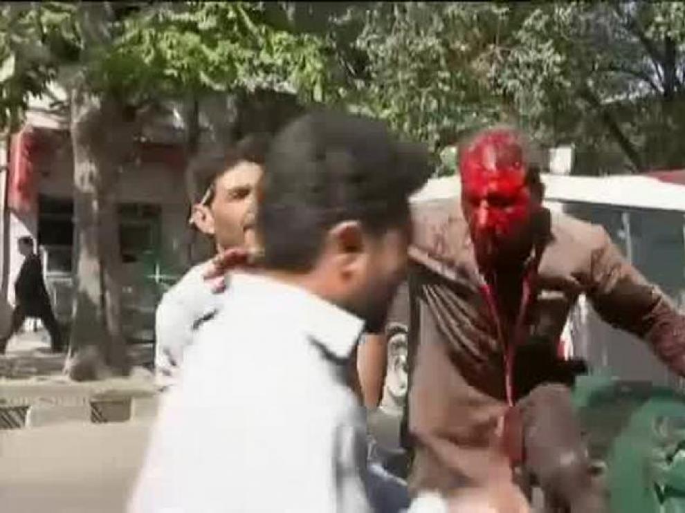 Un herido en el atentado de Kabul.
