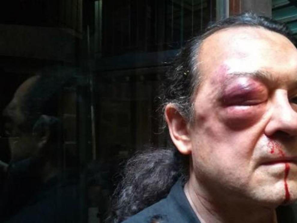 Imagen de Barredo tras la agresión.