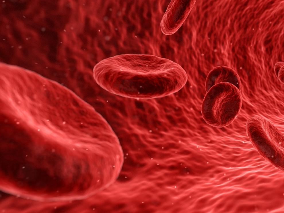 Este estudio evalúo el calcio arterial coronario en pacientes de entre 45 y 84 años.