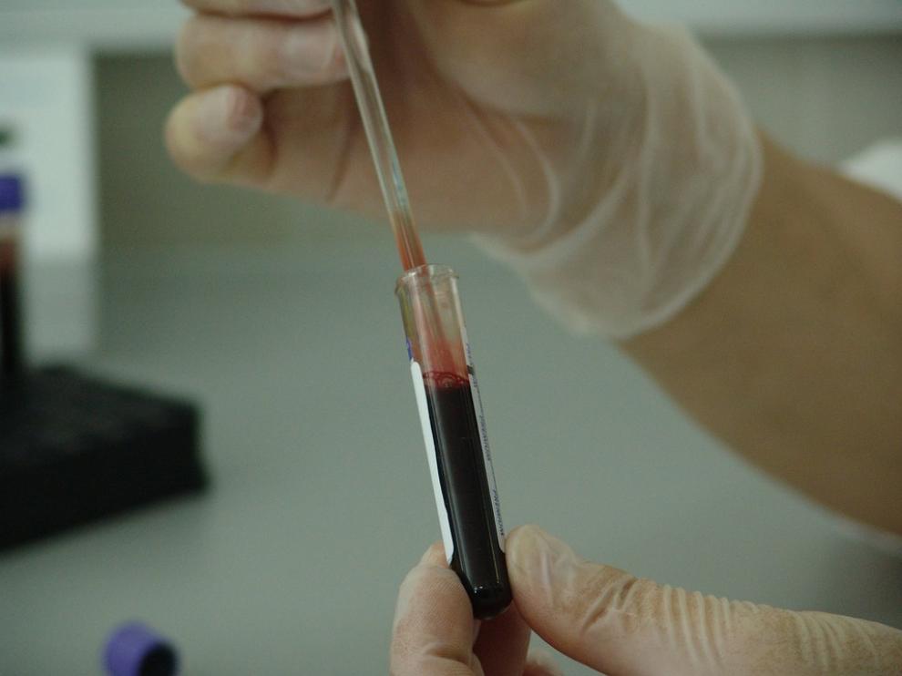 Un simple análisis de sangre permite detectar el VIH.