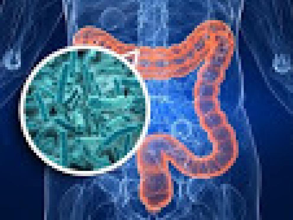 Un antibiótico común contra bacterias de la flora intestinal reduce un 30% el crecimiento del cáncer colorrectal en ratones