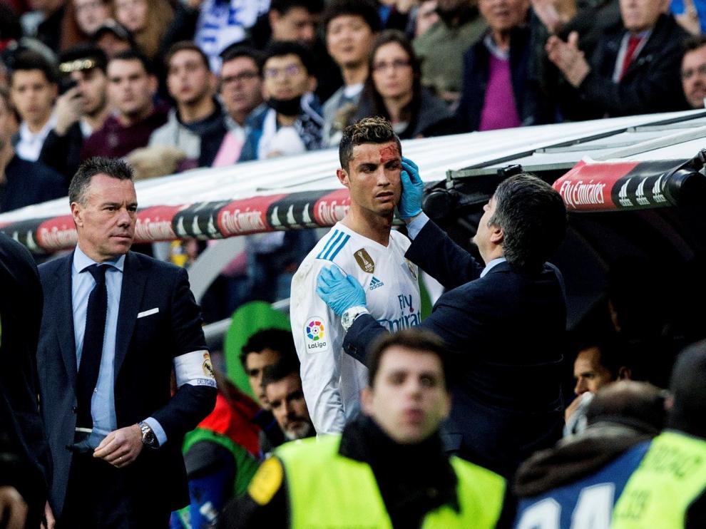 Cristiano Ronaldo es atendido de su brecha en la ceja.