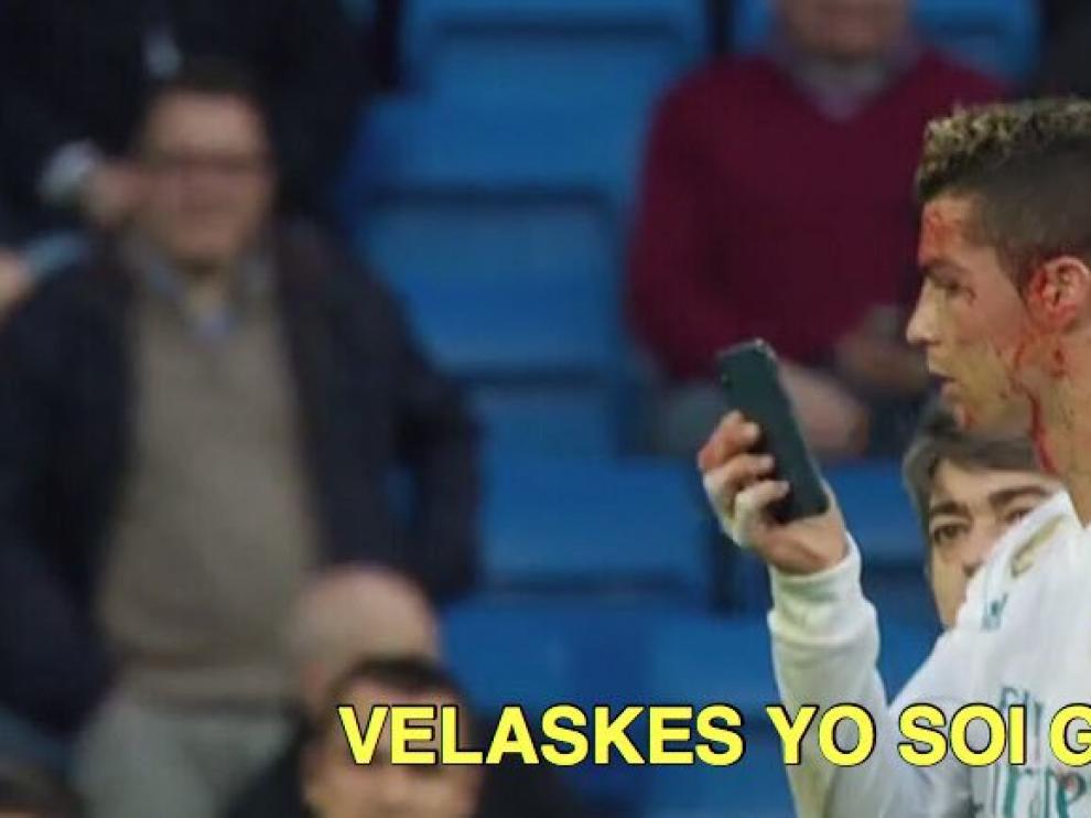 Cristiano Ronaldo sangrando.