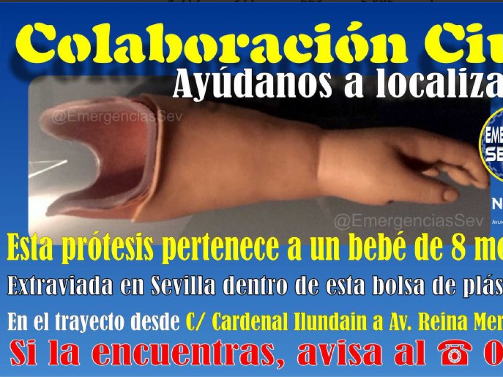 Foto de la prótesis de bebé perdida