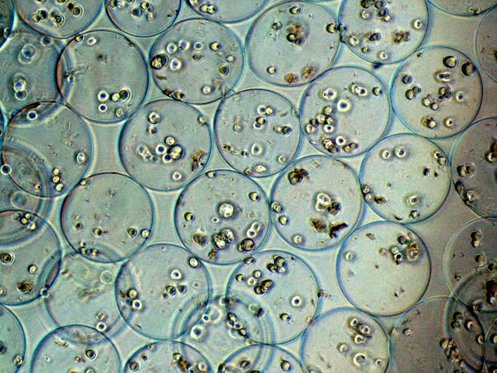 Células encapsuladas para su uso en terapia celular
