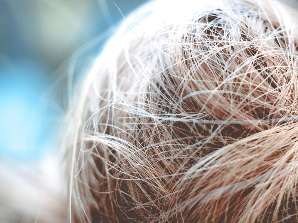 Un grupo de investigadores han encontrado una relación inesperada entre la aparición de las canas y las infecciones.