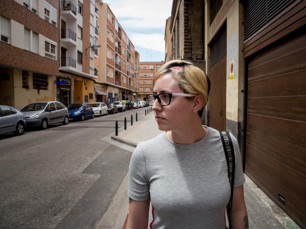 La quemadura que sufre Victoria Gaudes la mantiene incapacitada desde finales de abril.