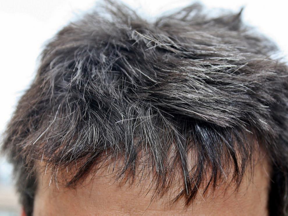 Los melanocitos del folículo piloso producen el pigmento que da color al cabello