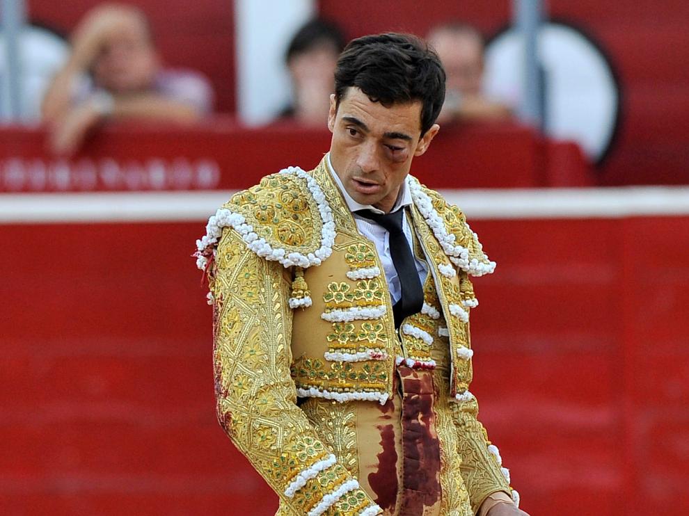 Paco Ureña, herido en el ojo.