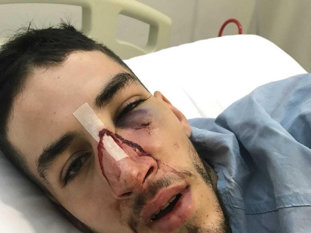 El jugador agredido tuvo que ser operado en un hospital de fractura facial y maxilar.