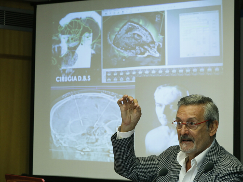 Javier López del Val, neurólogo del hospital Clínico, en la presentación del congreso en Zaragoza.
