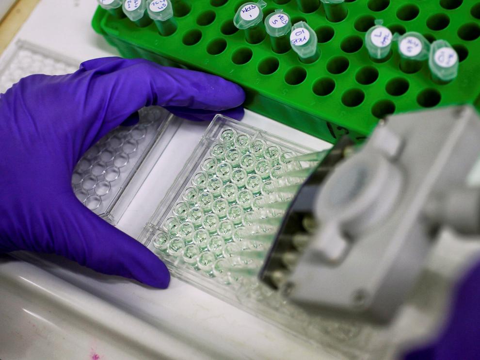Un científico trabaja con una muestra de cáncer en Inglaterra.