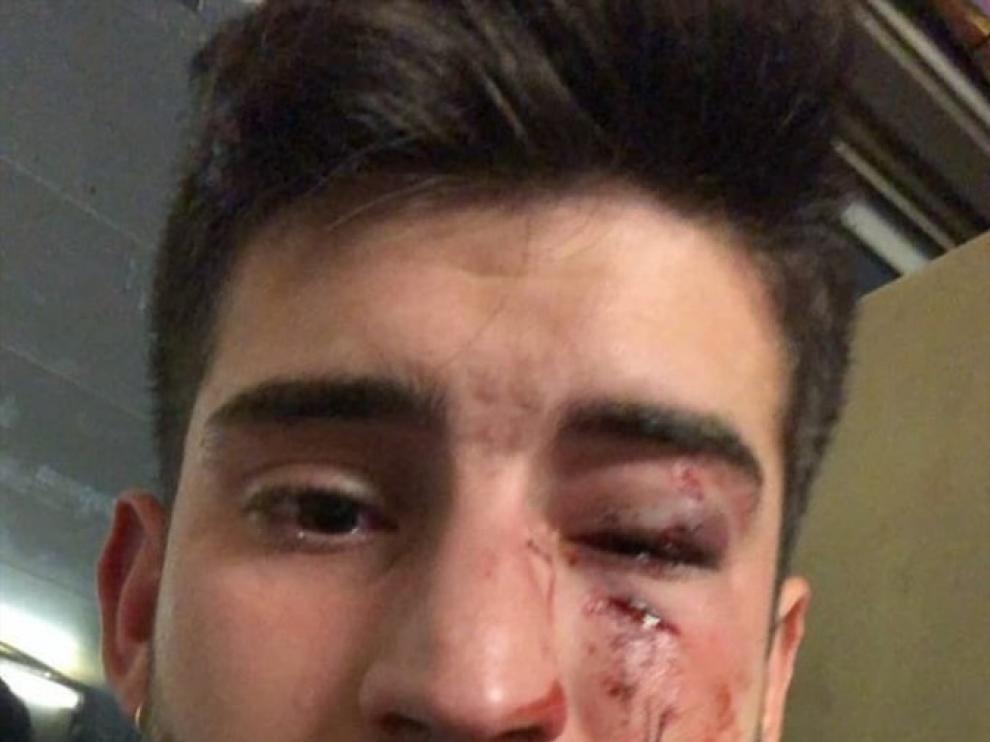 El joven agredido ha subido esta imagen a las redes sociales.
