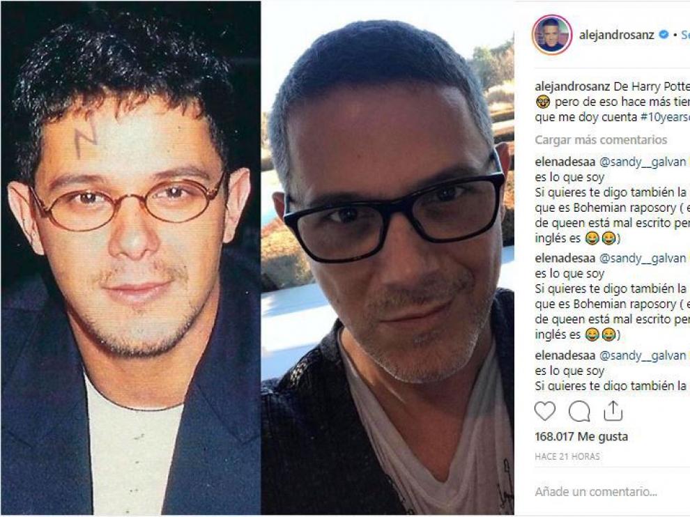 Alejandro Sanz muestra cómo ha cambiado en diez años.