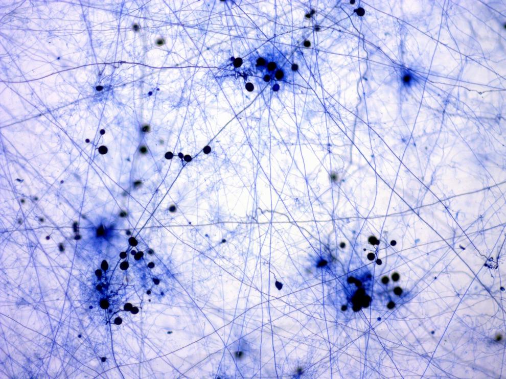 'Las redes sociales del bosque', ganadora en la Modalidad ‘Agricultura sostenible’ del certamen Fotciencia.