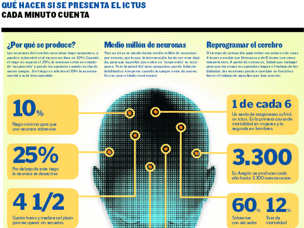 Da Mundial Del Ictus El Tratamiento Precoz Clave En El