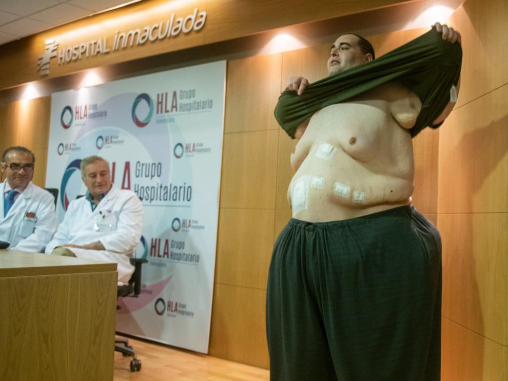 Teo Rodríguez, un joven valenciano de 34 años con obesidad mórbida que llegó a pesar 385 kilos.