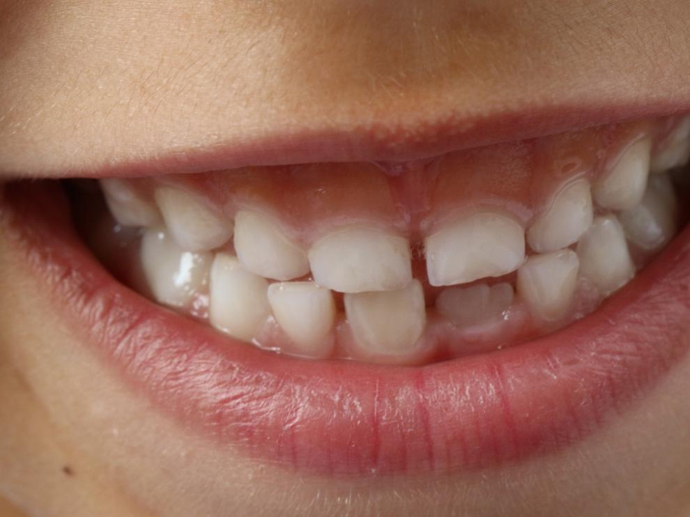 Los niños deben comenzar las visitas al dentista a los dos años.