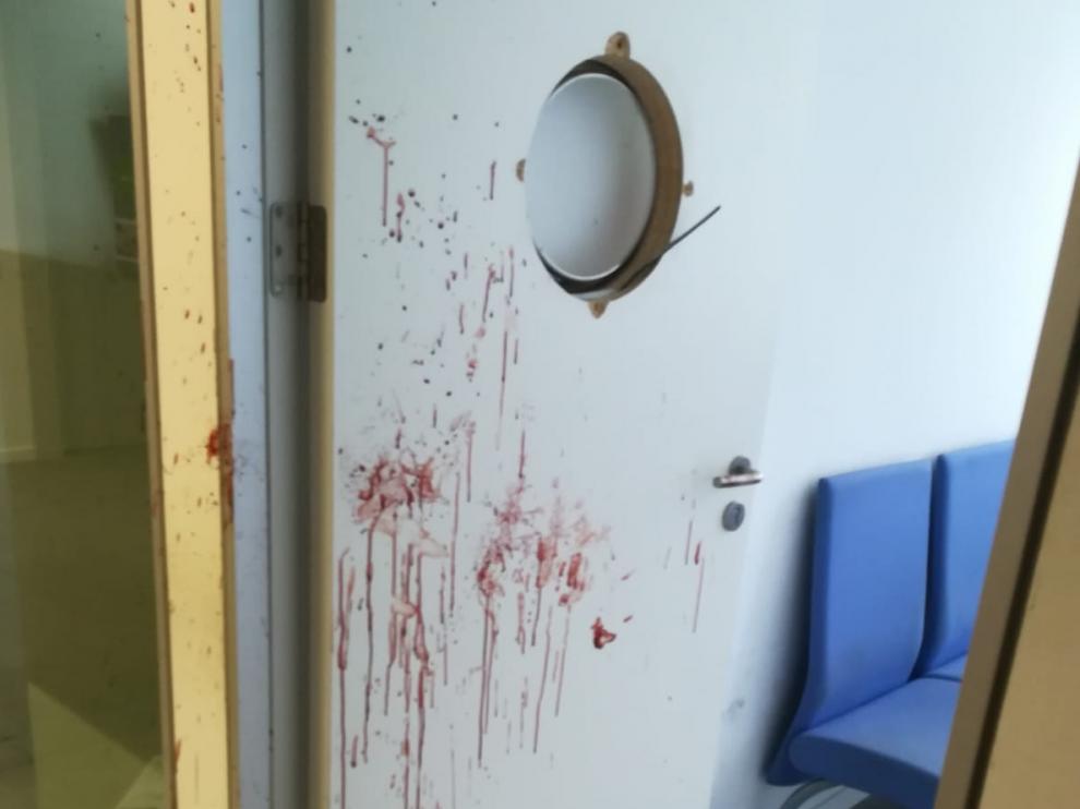 El joven dejó un enorme rastro de sangre en la puerta, de la que arrancó la claraboya a golpes.