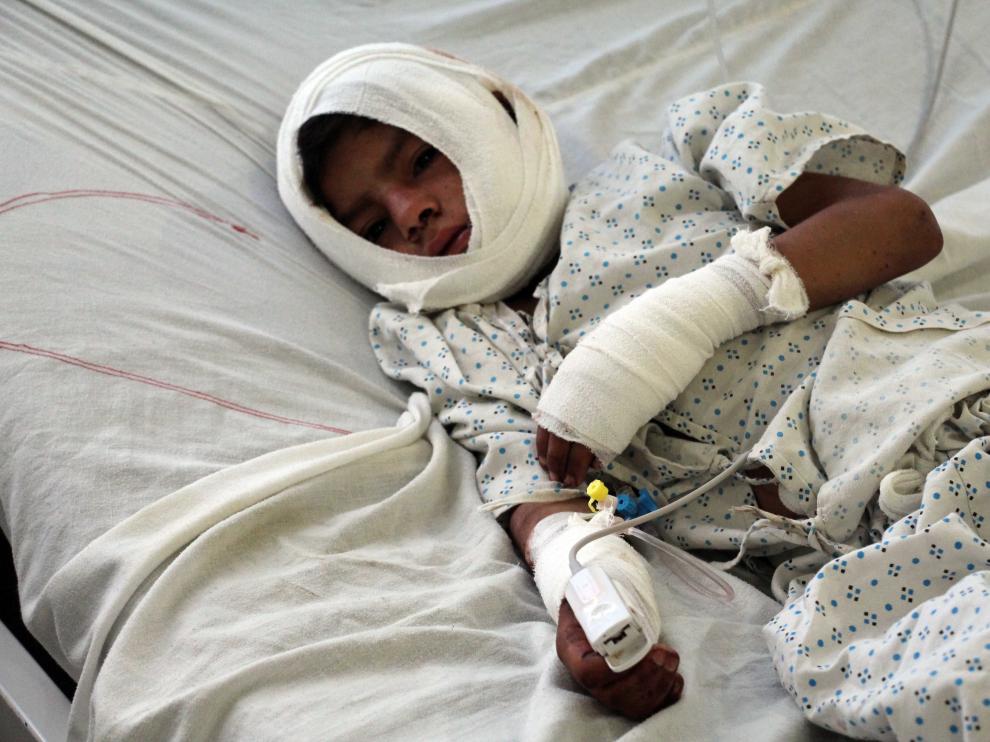 Un niño herido por una bomba recibe tratamiento médico en un hospital afgano.