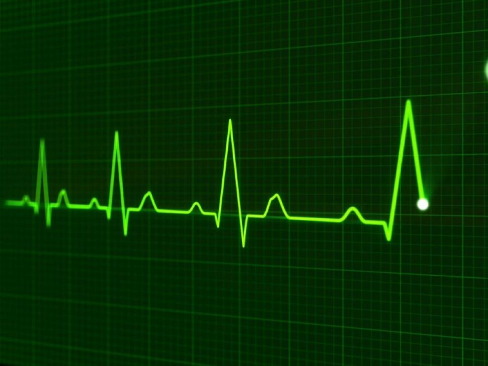 Electrocardiograma