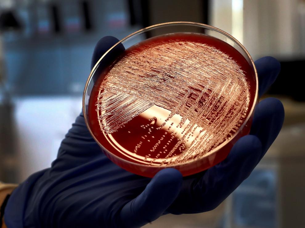 Cultivo de listeria en una placa de Petri, en el Laboratorio de Listeriosis del Centro Nacional de Microbiología.