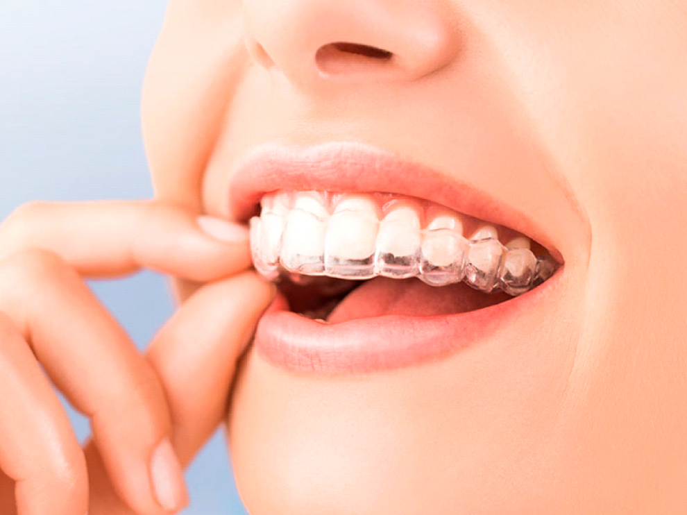 La ortodoncia es mucho más que conseguir una sonrisa estética