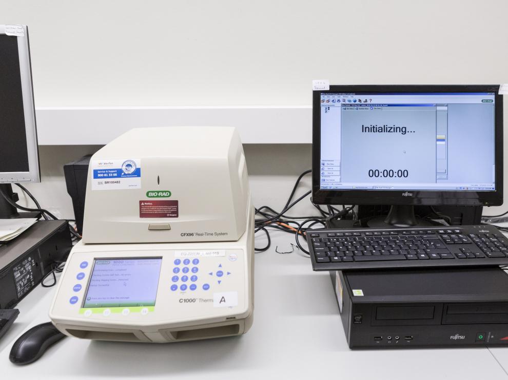 El laboratorio del hospital Miguel Servet ya cuenta con el test para analizar las muestras de posibles casos de coronavirus