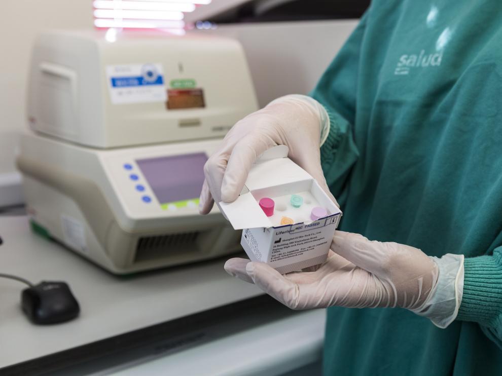 El laboratorio del hospital Miguel Servet ya cuenta con el test para analizar las muestras de posibles casos de coronavirus