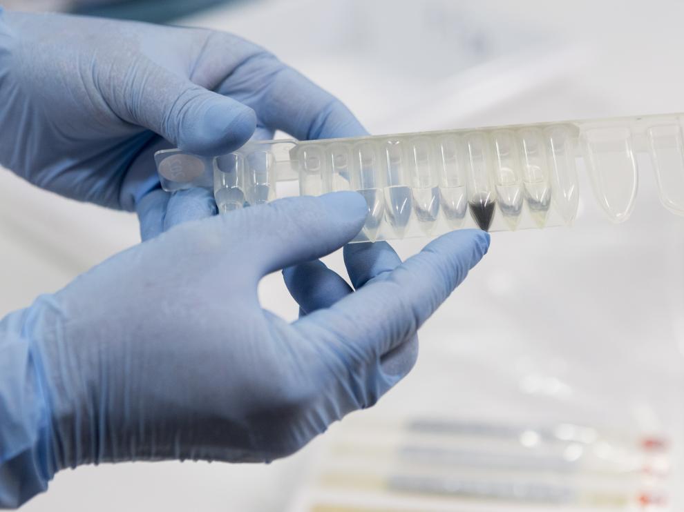 El laboratorio del hospital Miguel Servet ya cuenta con el test para analizar las muestras de posibles casos de coronavirus