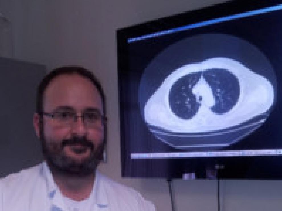 Íñigo Royo Crespo, nuevo director del hospital San Jorge de Huesca.