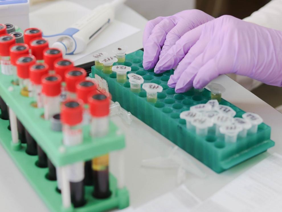 Procesado de muestras biológicas para el análisis por PCR.